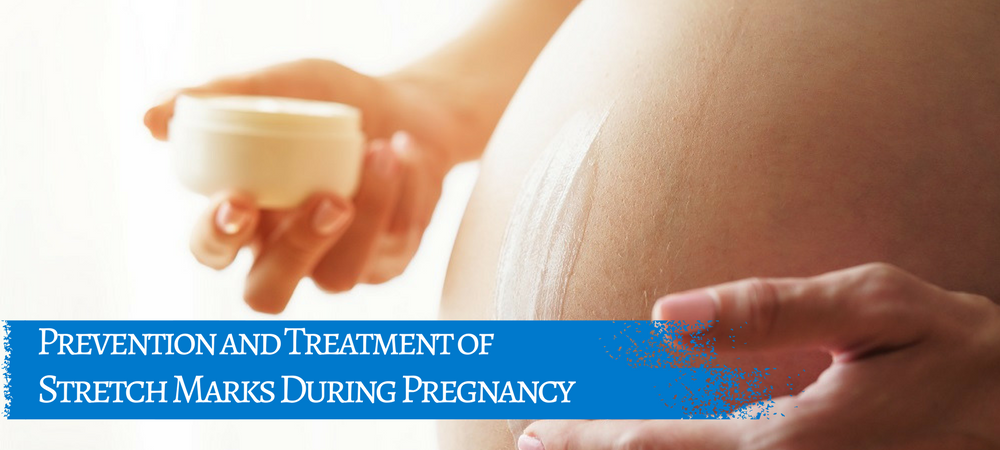 Prevention and Treatment of Stretch Marks During Pregnancy